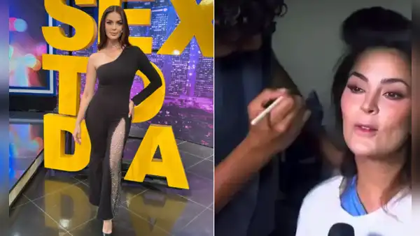 Laura Spoya confiesa que aún mantiene diente fracturado tras el accidente: ''Tengo que regresar a trabajar''