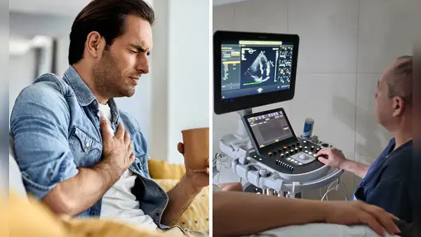 Crece el riesgo de infarto en peruanos menores de 50 años, alerta el Hospital Arzobispo Loayza