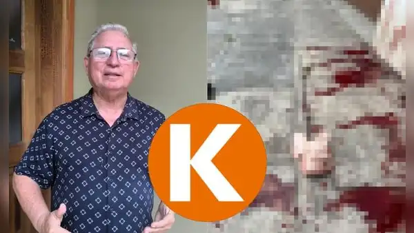 Iquitos: dejan cabeza de cerdo con restos de sangre frente a vivienda de excandidato de Fuerza Popular