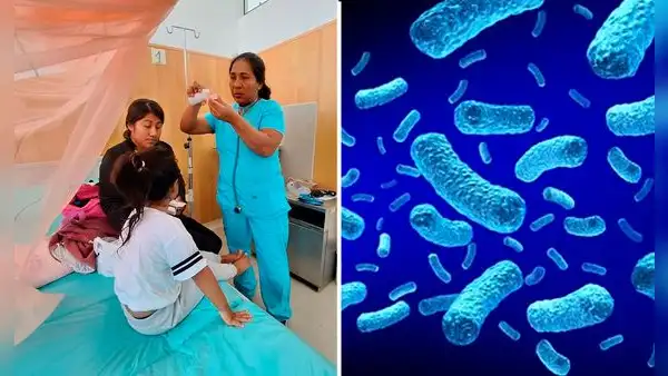 Tos ferina aumenta en los primeros meses del 2026: 719 casos de contagios y 12 niños fallecidos en el Perú, según Minsa