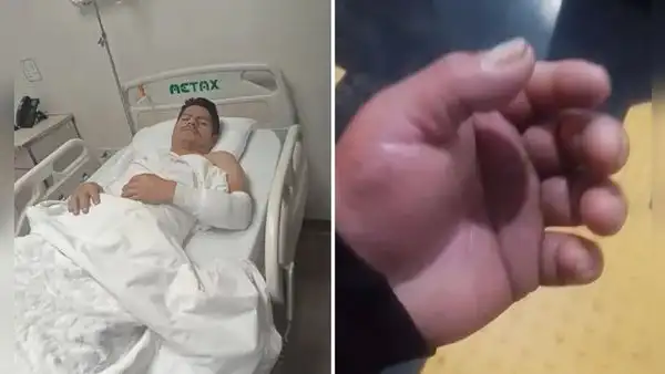 Agente de la ATU agredido con un martillo en el Metropolitano por pasajero denuncia falta de apoyo y la no renovación de su contrato: "Me abandonaron a mi suerte"