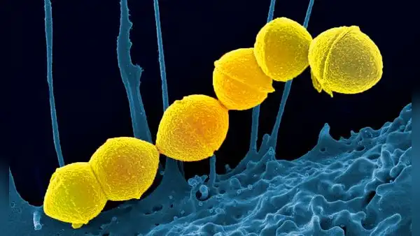 Una momia prehispánica revela que la bacteria de la faringitis ya existía en América antes de la llegada de los europeos