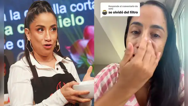 Nelly Rossinelli se muestra sin filtros, con sus imperfecciones y revela por qué le salieron manchas oscuras en el rostro