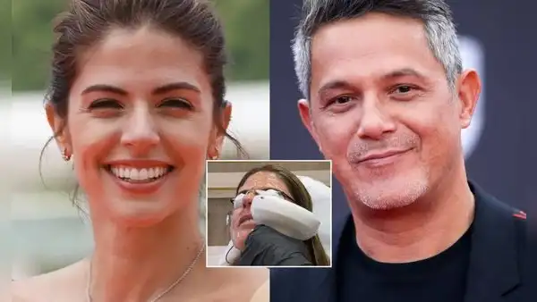 Stephanie Cayo impacta con tratamiento estético en el rostro para lucir más joven en medio de romance con Alejandro Sanz