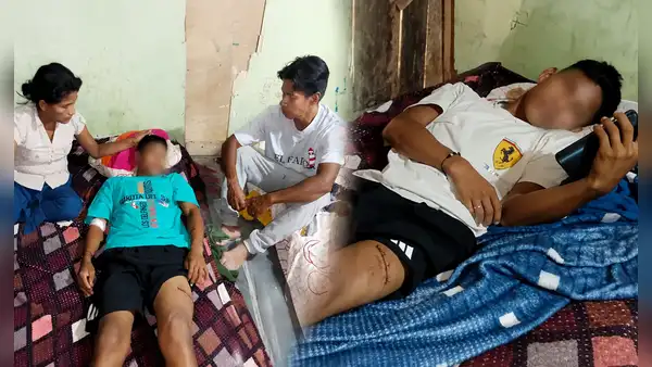 Escolar que sobrevivió tras caerle una pared en colegio de Iquitos recibió alta y necesita rehabilitación