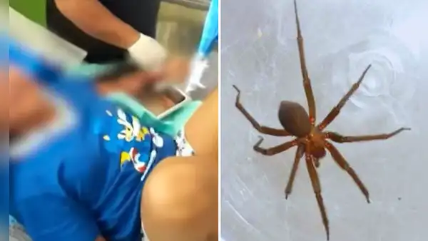 Menor fallece tras ser mordida por una araña en su vivienda: ataque le habría provocado insuficiencia renal aguda