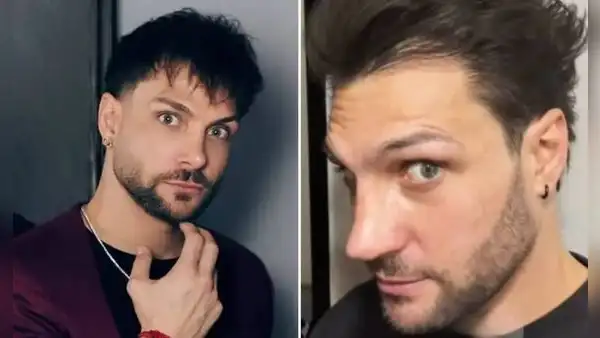Nicola Porcella sorprende al mostrar su renovada nariz tras someterse a una nueva operación y genera reacciones