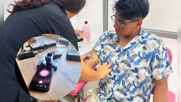 Peruano convierte celular en microscopio para detectar anemia con IA: pruebas arrojan 92% de precisión