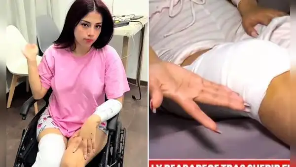 TikToker Zully recibe 40 puntos en la pierna tras sufrir aparatoso accidente y reaparece en silla de ruedas: "Tuve todos esos cortes"