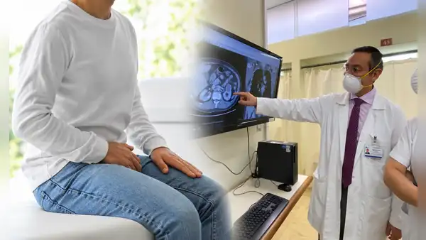 INEN ofrece evaluación gratuita de próstata a más de 1.000 hombres en Surquillo: ¿cómo acceder?
