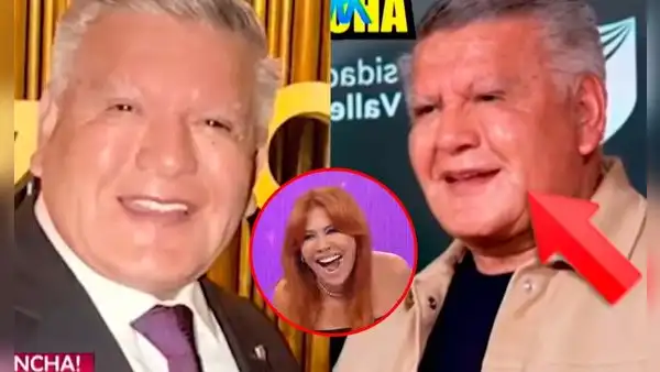 Magaly Medina expone 'nuevo rostro' de César Acuña tras someterse a cirugía y lanza cruel comentario: "Le han hecho una monstruosidad"