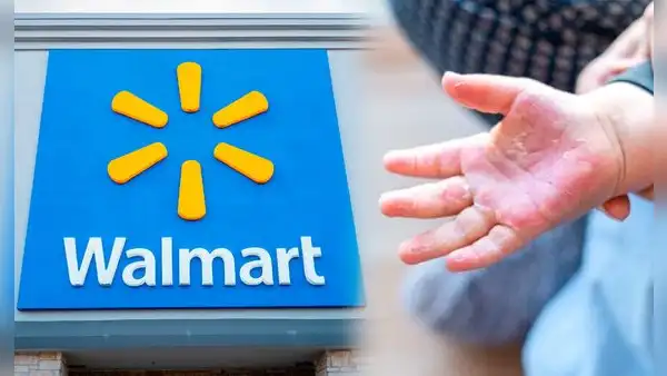 Terror para clientes de Walmart | Este reconocido producto muy utilizado para bebés fue retirado de tiendas: Generaría reacciones cutáneas