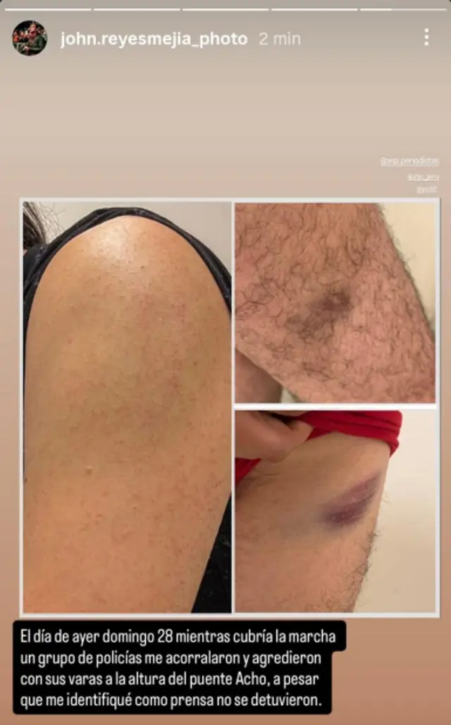  Golpes que recibió el fotógrafo de La República 