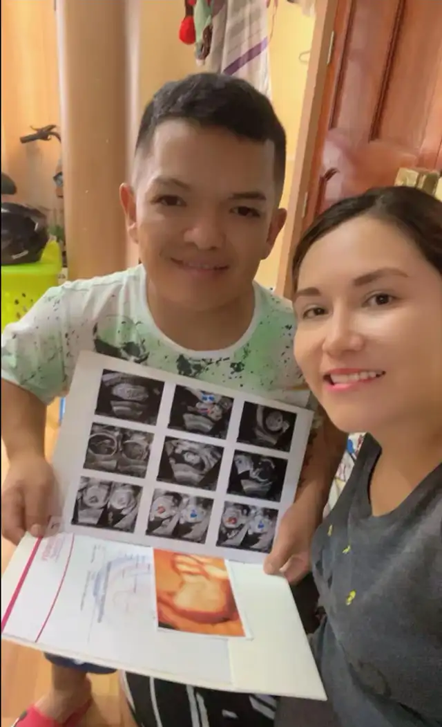 Cómico Kiwi anunció que se convertirá en padre por primera vez. Foto: Facebook. Cómico Kiwi anunció que se convertirá en padre por primera vez. Foto: Facebook.