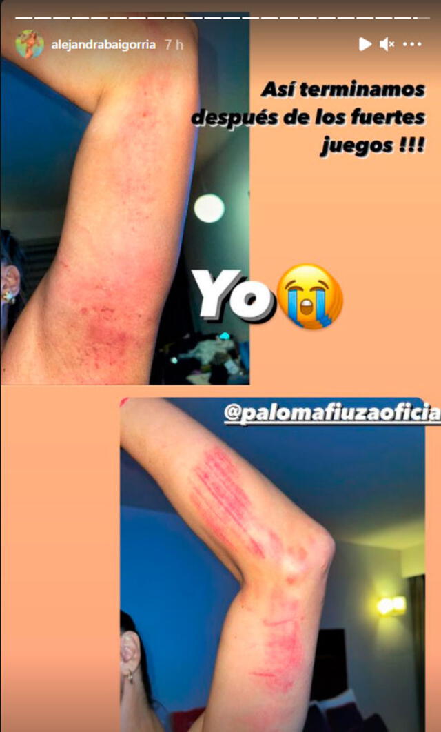 Las 'guerreras' quedaron con lesiones en los brazos tras el fuerte ensayo en el set de Televisa. Foto: Alejandra Baigorria / Instagram