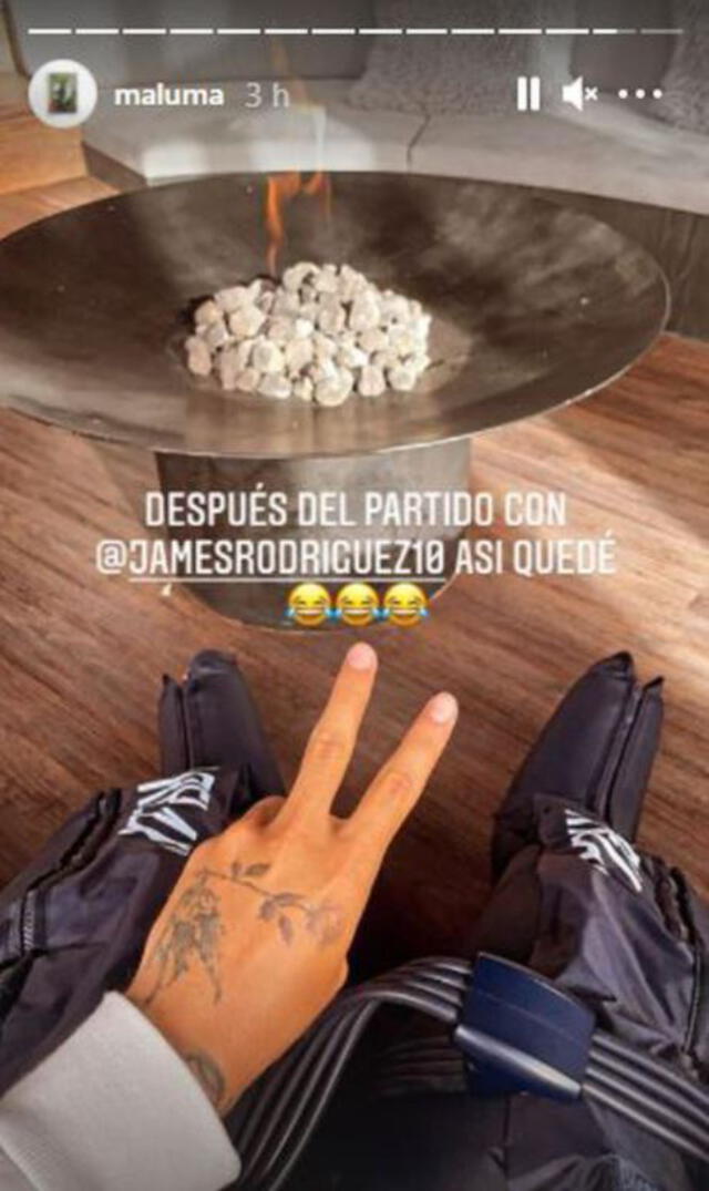Maluma mostró lo que tuvo que usar tras jugar con James Rodríguez.
