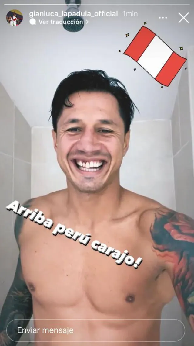 En Instagram, Lapadula mostró cómo quedaron sus dientes.