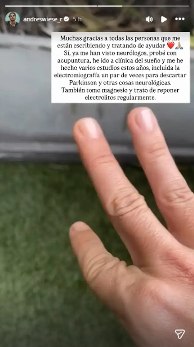 Andrés Wiese preocupó a sus seguidores en redes sociales. Foto: Instagram