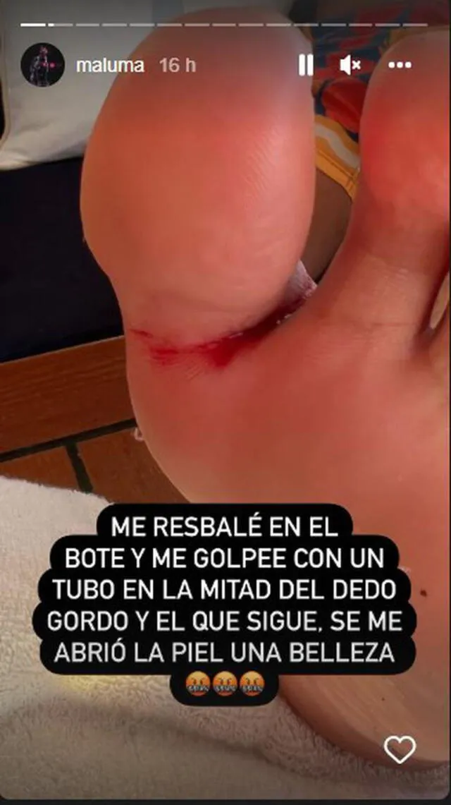 Maluma sufre accidente en el pie