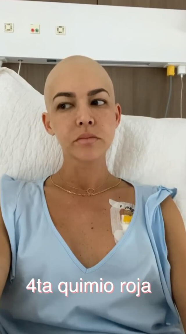 Anahí de Cárdenas reveló preocupantes efectos secundarios de la quimioterapia.