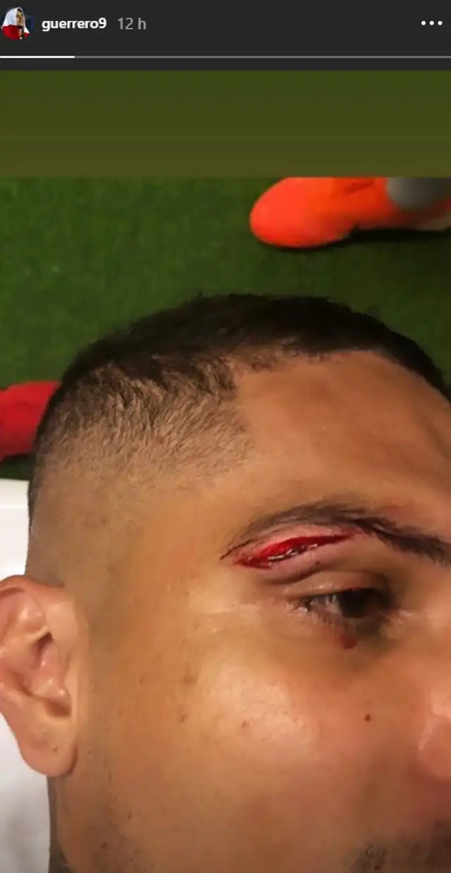 Paolo Guerrero - Internacional