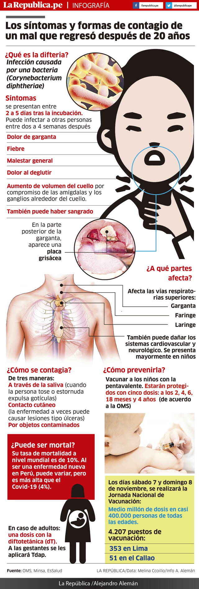 sintomas difteria infografia