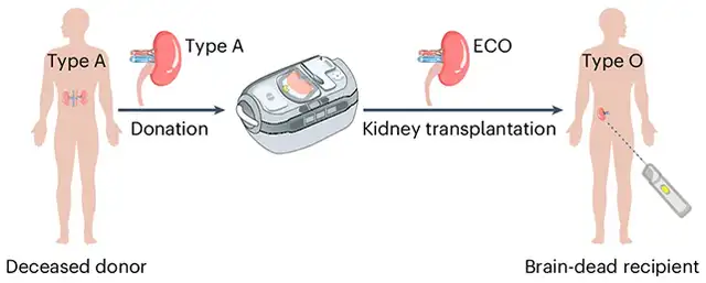  Los investigadores produjeron un riñón de tipo O convertido enzimáticamente, listo para trasplante. Foto: Nature Biomedical Engineering   