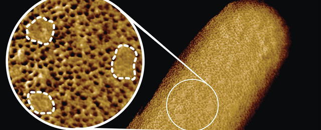 Las imágenes conseguidas de las bacterias abrirán una etapa de investigaciones con enfoques modernos. Foto: UCL