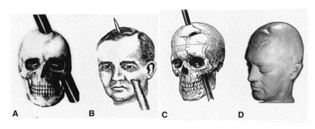 Distintas recreaciones del accidente que sufrió Phineas Gage Foto: Psicología y Mente   