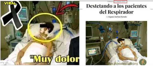 Imágenes del post viral (izquierda) y del portal AnestesiaR (derecha). Foto: composición.