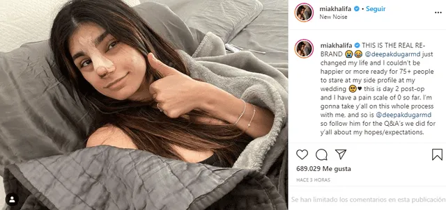 Mia Khalifa se operó la nariz. Foto: Instagram.