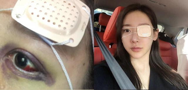 Tras la noticia de su divorcio, resurgieron los rumores de que Song Da Ye había sido agredida por Kim Sang Hyuk el día antes de su boda. 5 de abril, 2019. Tras la noticia de su divorcio, resurgieron los rumores de que Song Da Ye había sido agredida por Kim Sang Hyuk el día antes de su boda. 5 de abril, 2019.