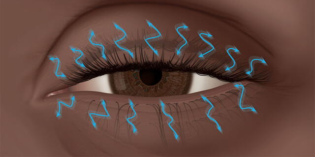 El espasmo ocular es uno de los malestares más comunes en la población mundial. Foto: American Academy of Ophthalmology    