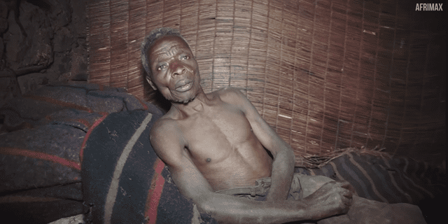 Callixte Nzamwita atraviesa por esta situación desde los 16 años. Foto: Afrimax.   