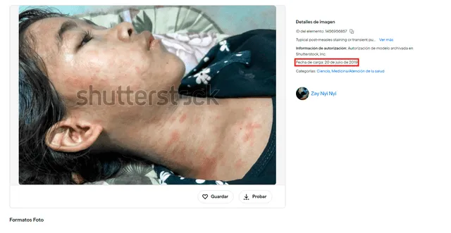 <em> Fotografía de menor enferma presuntamente de chikungunya. Foto: captura de pantalla</em>   