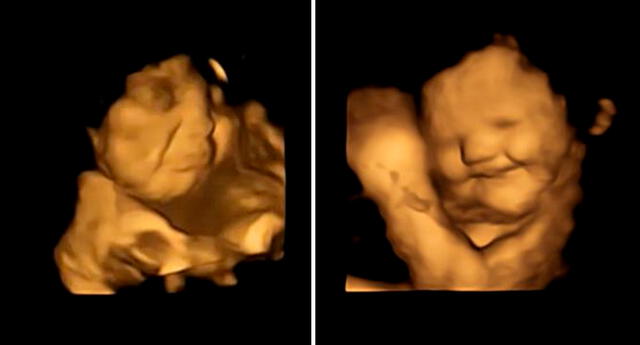 ¿Los bebés reaccionan al gusto y al olor desde el vientre?