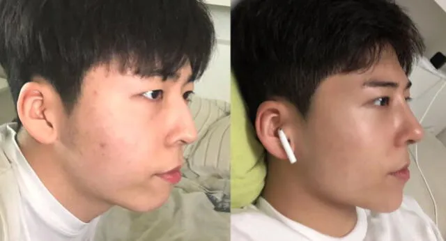 Min Seo muestra el antes y después de sus cirugías. Foto: captura