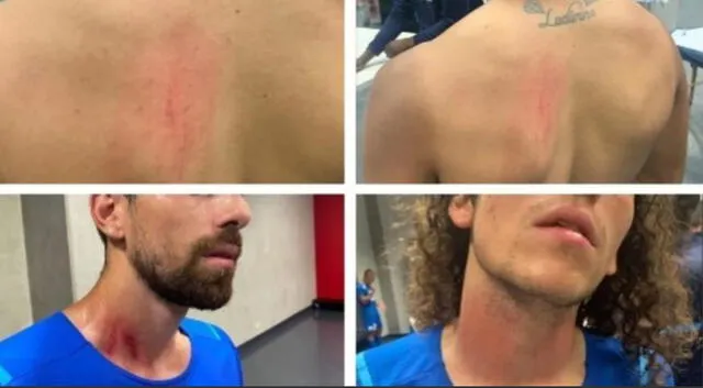 Luan Peres y Mateo Guendouzi, jugadores del Marsella, presentaron rasguños en la zona del cuello.