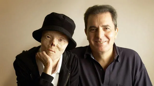 Su padre, Amadeo, dejó su empleo para dedicarse por completo al cuidado de su hija Jacqui. Foto: TN.    