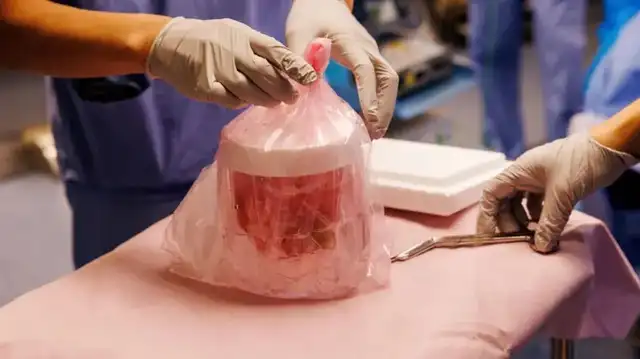 El xenotrasplante podría ser una solución ante la falta de donantes vivos. El xenotrasplante podría ser una solución ante la falta de donantes vivos.