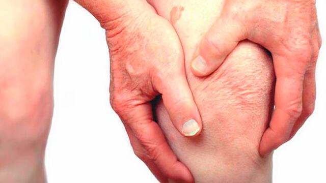 La Artrosis es un tipo de artritis que se produce cuando el tejido flexible en los extremos de los huesos se desgasta. Foto Difusión.