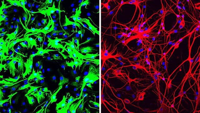 Astrocitos de cerebro de ratón (izquierda) se convirtieron en neuronas (derecha). UC San Diego Health Sciences.
