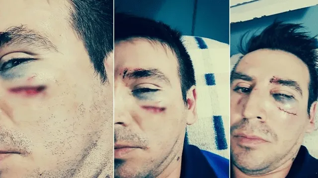 Profesor acosador fue duramente golpeado por padrastro de escolar [VIDEO]