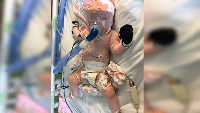 Bebé sobrevivió a un trasplante de corazón, pero se contagió de coronavirus en el hospital