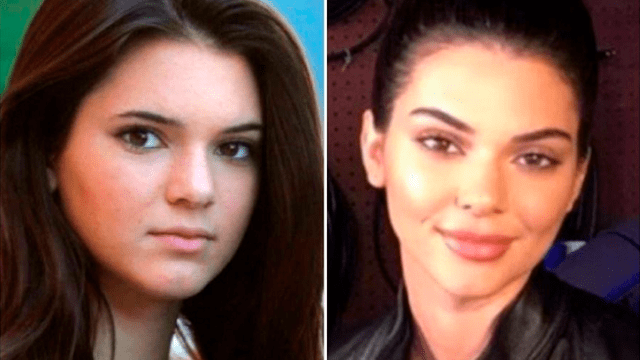 Kendall Jenner, antes y después