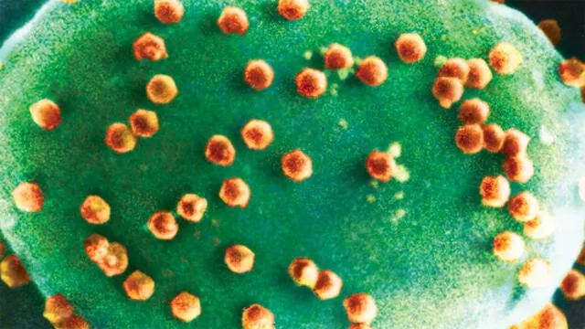 Clorovirus infectando algas verdes microscópicas. Foto: Kit Lee / Angie Fox