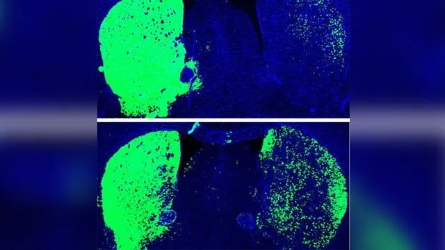 Cerebro de los ratones. Arriba: neuronas productoras de dopamina (verde) antes del tratamiento. Abajo: después del tratamiento. Fuente: UC San Diego Health Sciences.