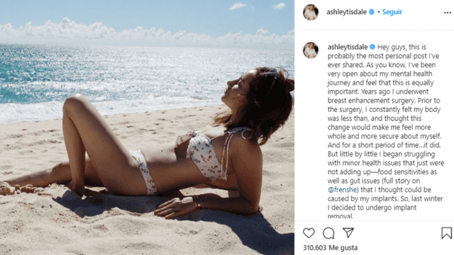 Ashley Tisdale reveló en Instagram que se quitó los implantes de senos porque le ocasionaron problemas de salud