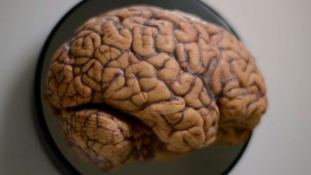 El cerebro humano comparte varias características con los encéfalos de cerdos. Foto: BBC.