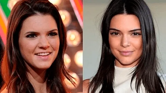 Kendall Jenner, antes y después.